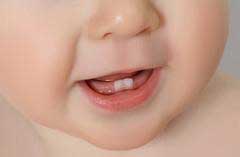 ٨٥ درصد  دندانها در جلوي فك پايين كودك ديده مي شود.